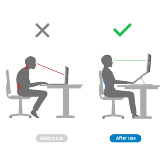 Laptop standı gümüş renk ayarlanabilir alüminyum ergonomik