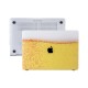 MacBook Air Kılıf 13inc HardCase A1369 A1466 Uyumlu Koruyucu Kılıf Fizzy